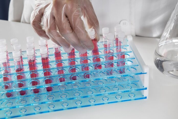 Escovas técnicas mantêm higienização eficiente de vidrarias em laboratórios