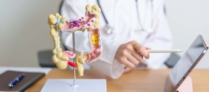 Doctor with human Colon anatomy model and tablet. Colonic diseas Campanha Março Azul alerta para o câncer colorretal